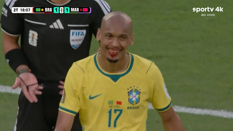 Fabinho nariz ensanguentado durante Brasil x Marrocos