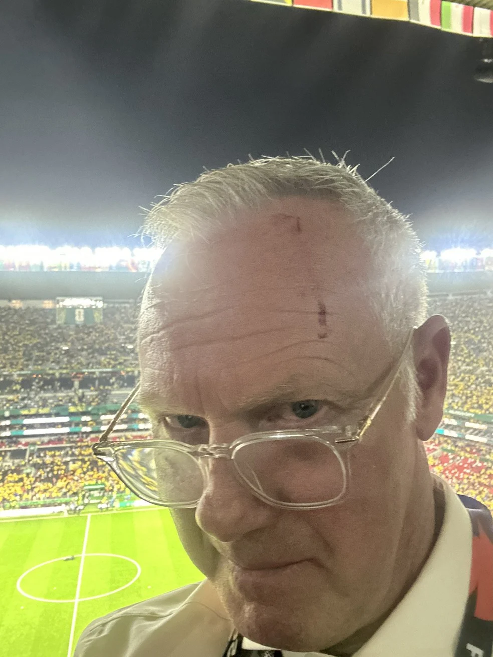 Warren Barton com corte na testa após ser atingido por garrafa