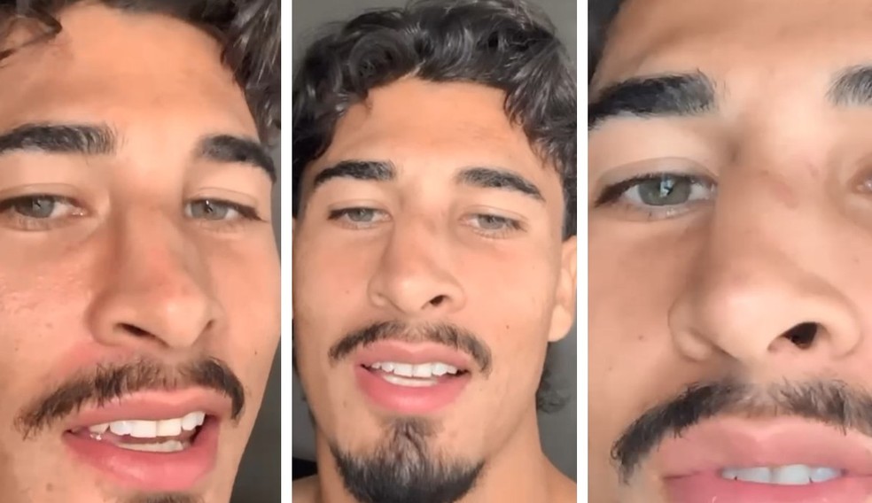 Mikael Altos nariz em foto após choque
