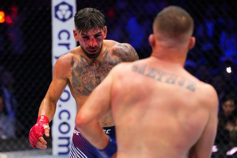 Ilia Topuria com fraturas no rosto após UFC Casa Branca